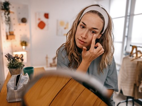 Как убрать синяки под глазами?