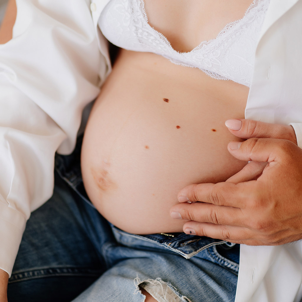 Як попередити появу пігментації під час вагітності - 1
