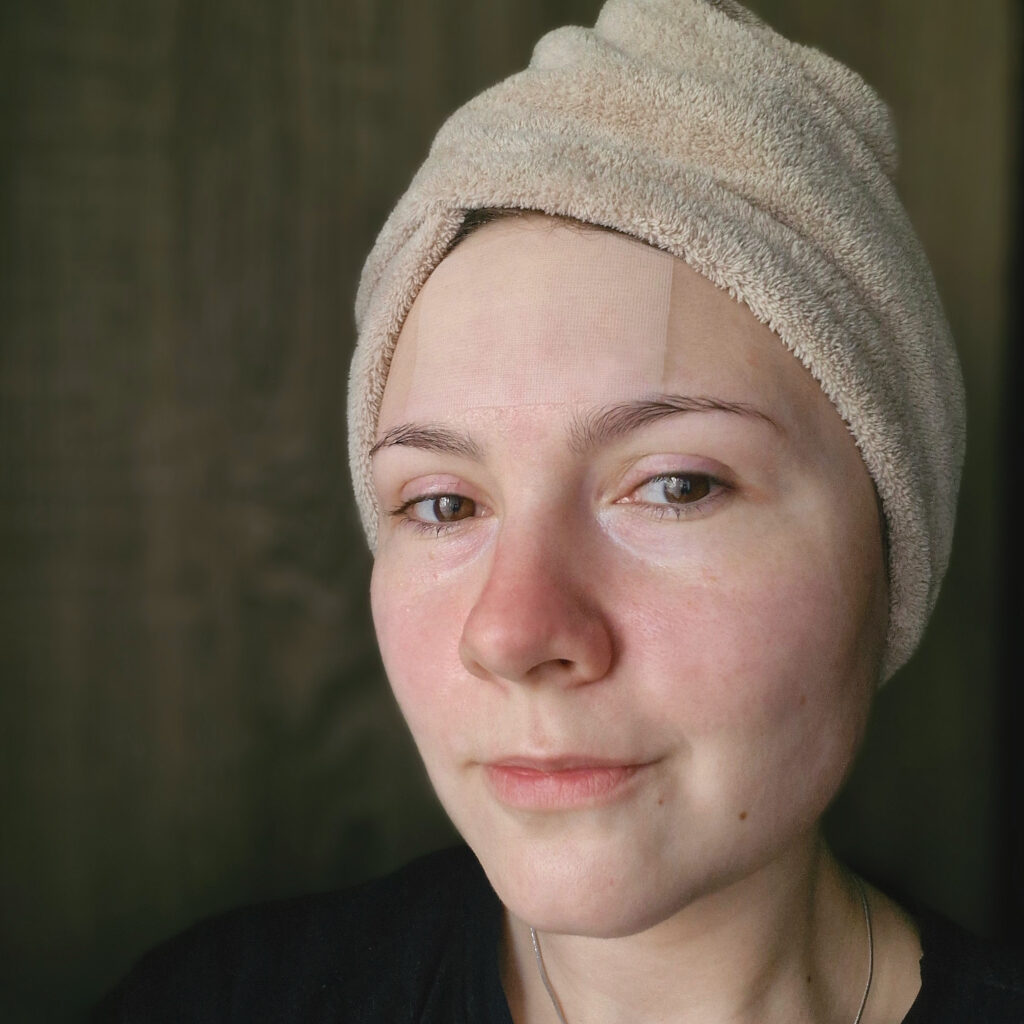 11 Тестуємо розчинні патчі P Calm Hyaluronic Acid Melting Patch - Мар'яна