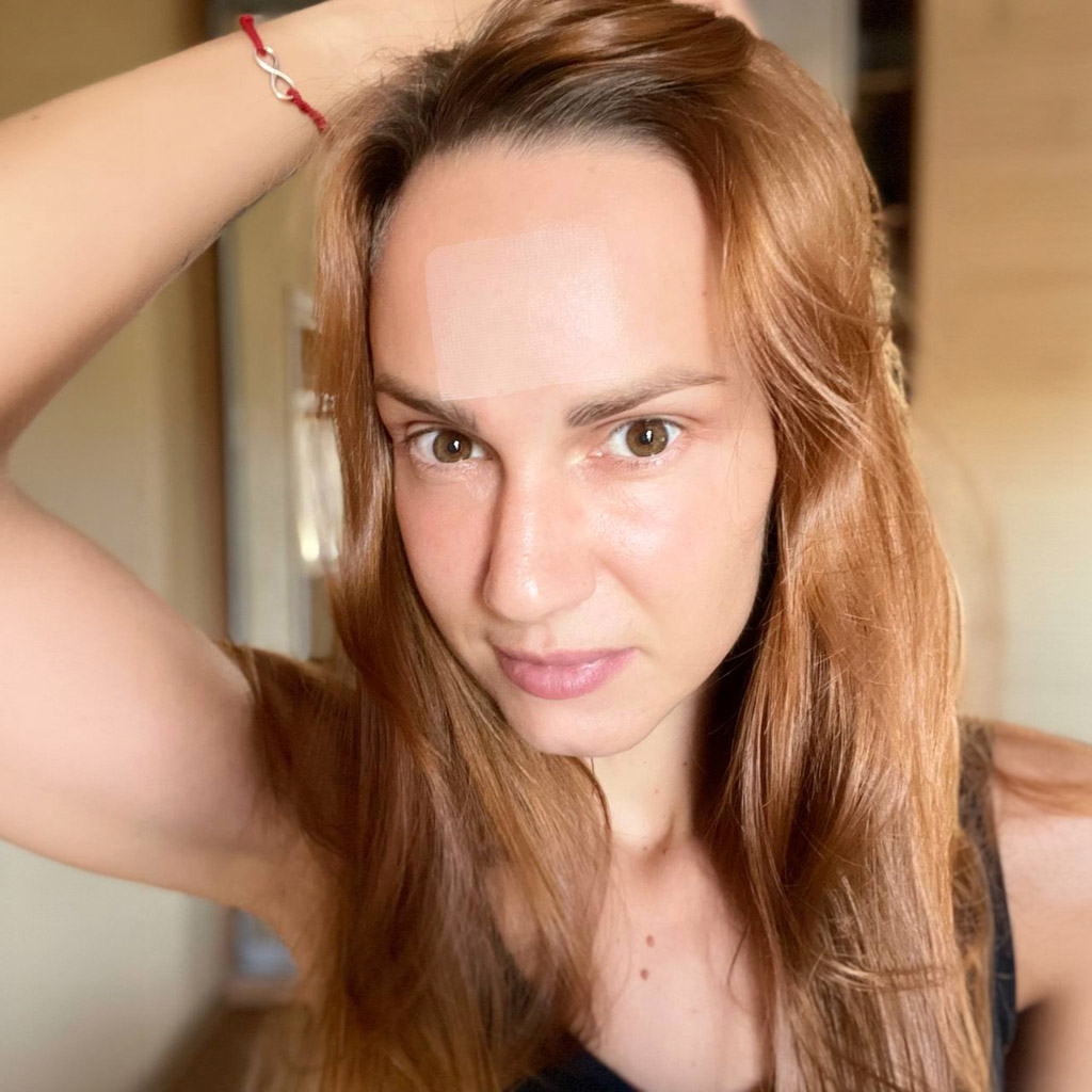 15-Тестуємо-розчинні-патчі-P-Calm-Hyaluronic-Acid-Melting-Patch---Ксенія