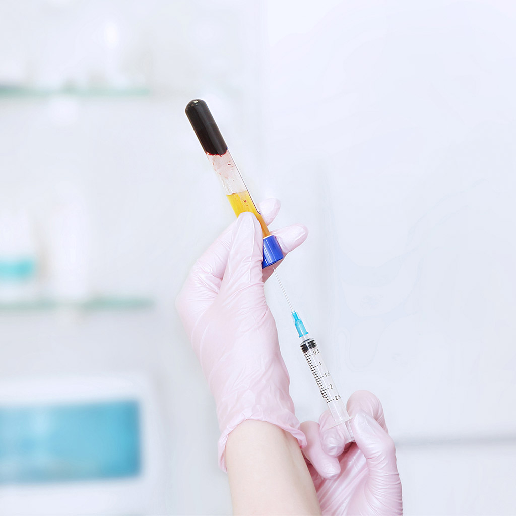 3-Вампірська-підтяжка-обличчя