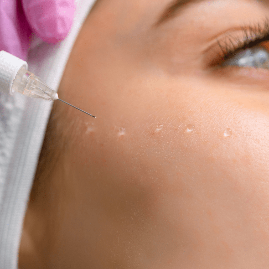 біоревіталізація та мезотерапія