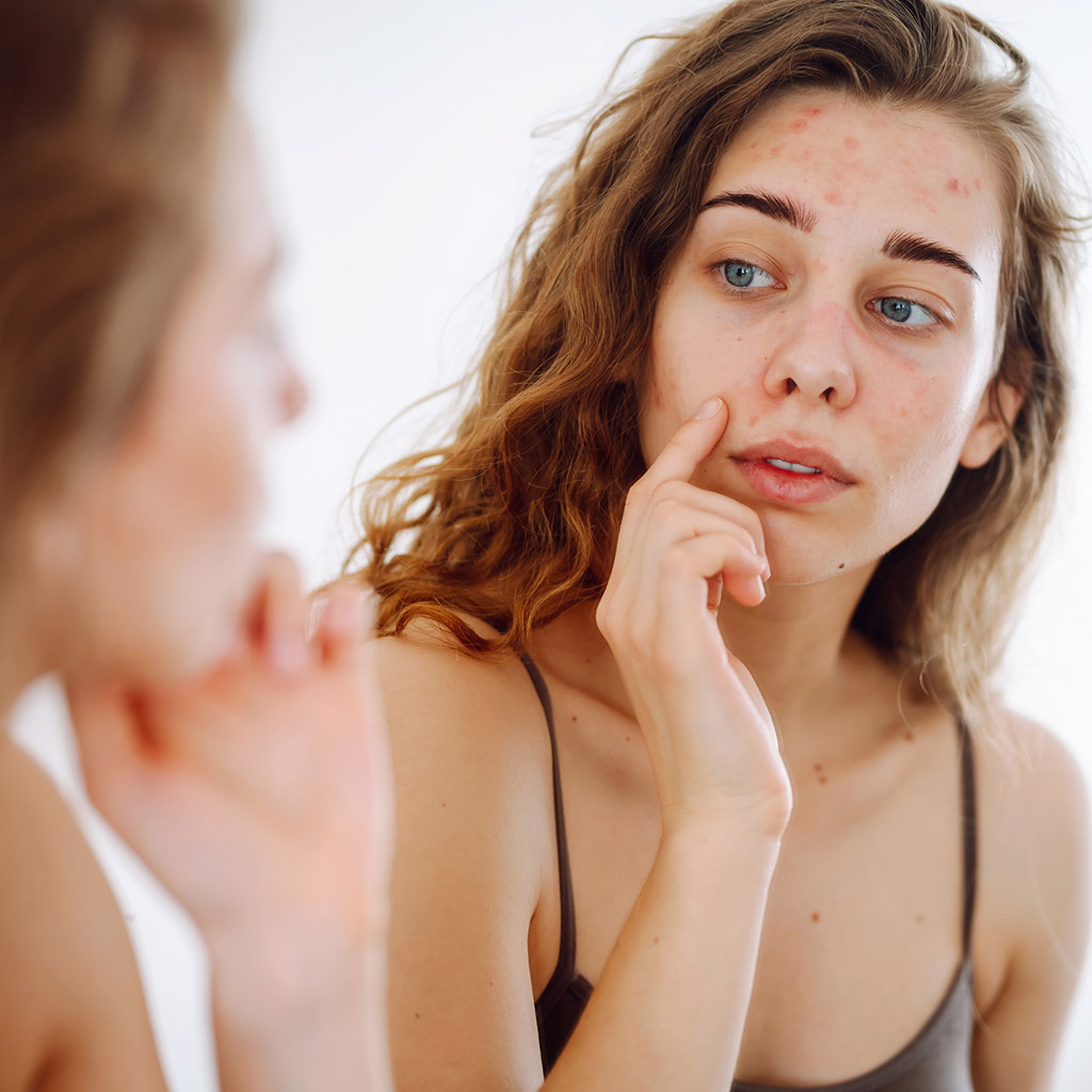 6-Мікробіом-шкіри