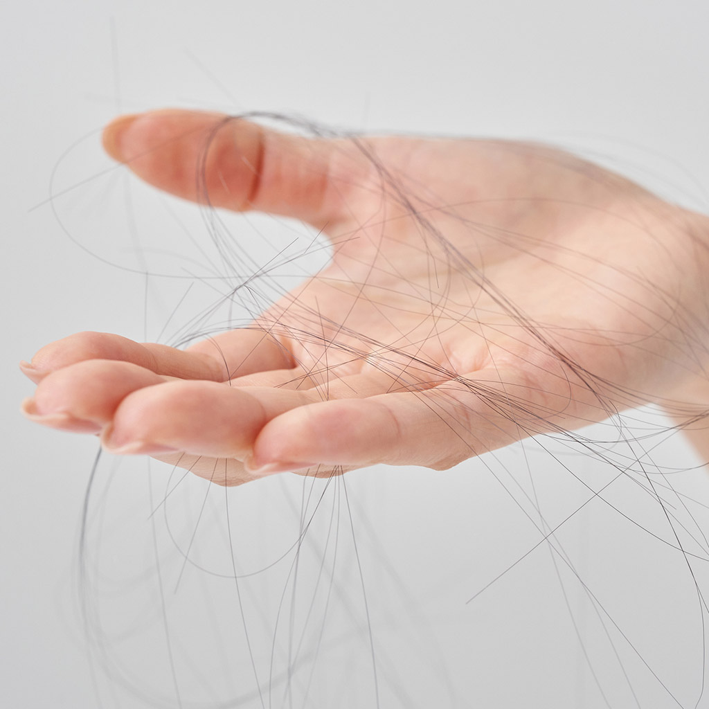 9-Зимове-випадіння-волосся