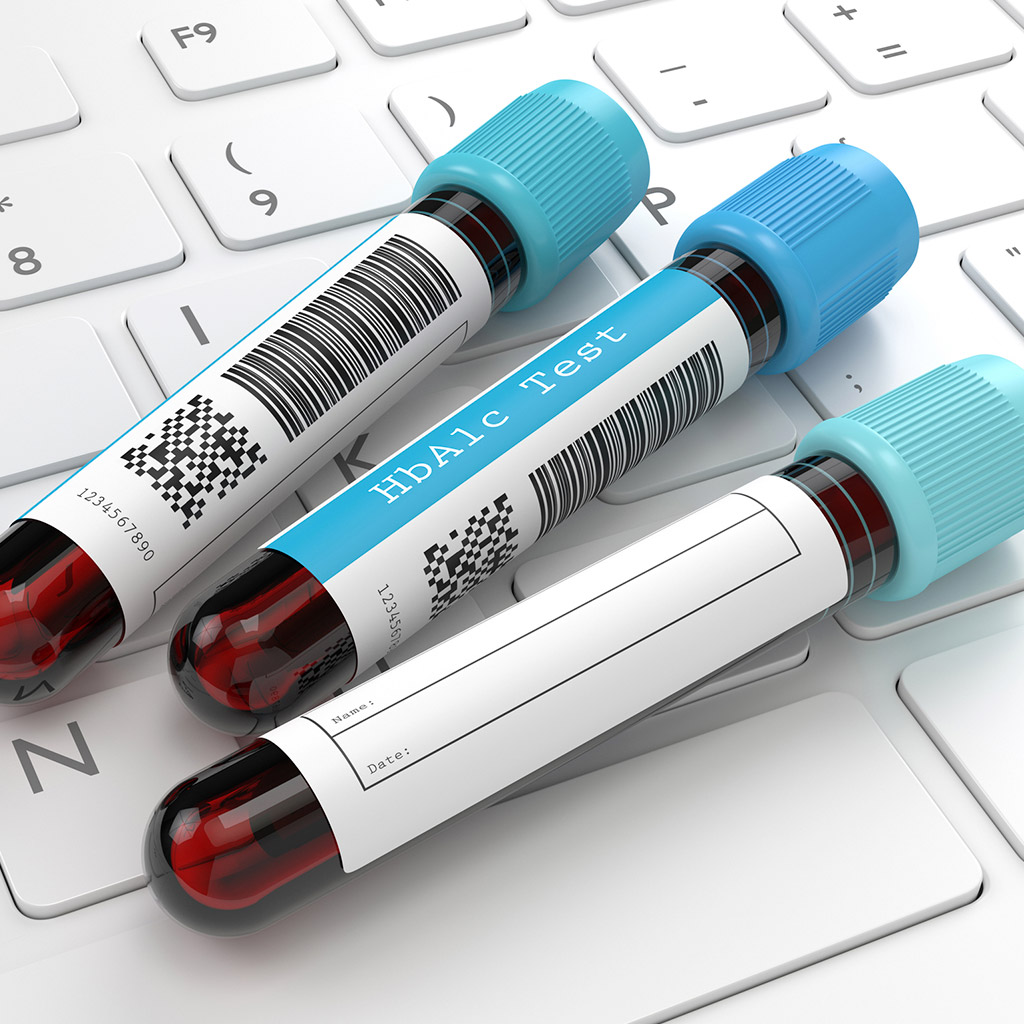 1-Продукти-з-низьким-глікемічним-індексом