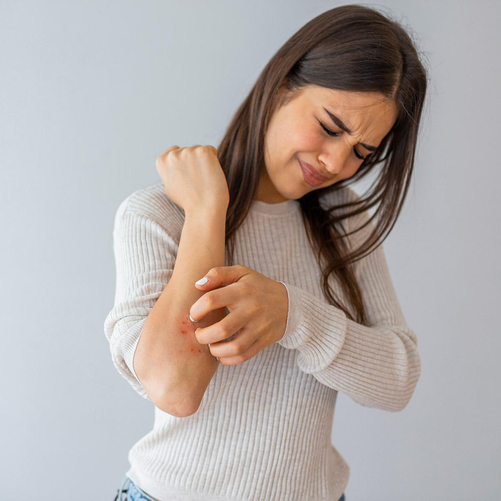 5-Все,-що-тобі-потрібно-знати-про-холодову-алергію