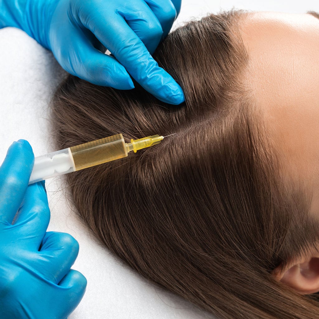 3-Ін’єкційні-процедури-в-трихології